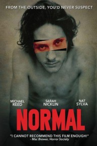 Normal