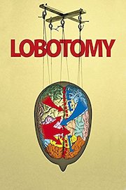 Lobotomy