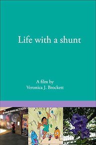 Life with a shunt
