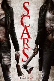 Scars