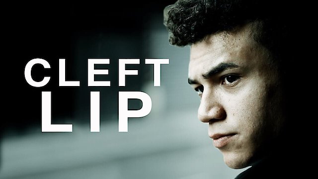 Watch Cleft Lip Online