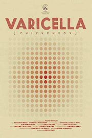 Chickenpox