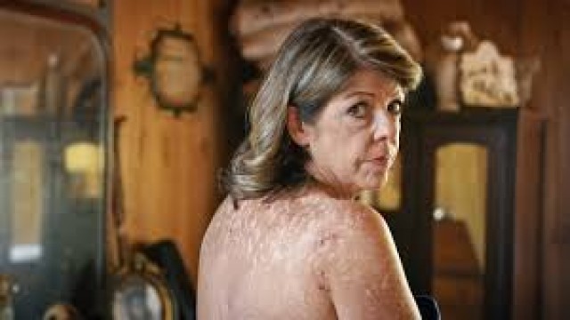 Watch Skin Deep: The Battle Over Morgellons Online