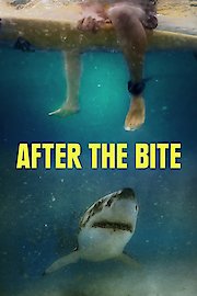 After the Bite