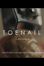 Toenail poster