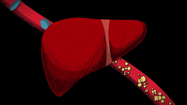 Watch The Cholesterol Question Online