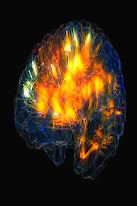 Bettering the Brain
