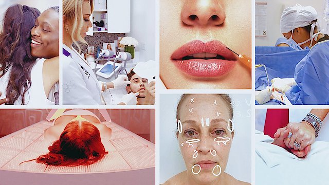 Watch Skin Decision: Before and After Online