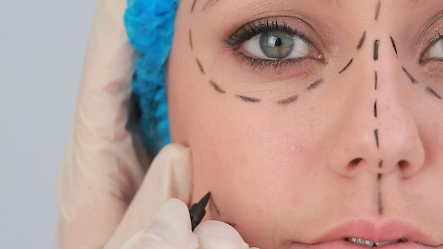 Watch Plastic Surgery Knifemares Online