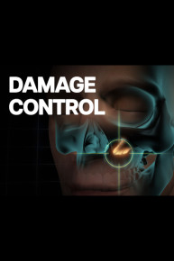 Damage Control